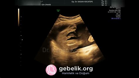renkli ultrasonda erkek bebek